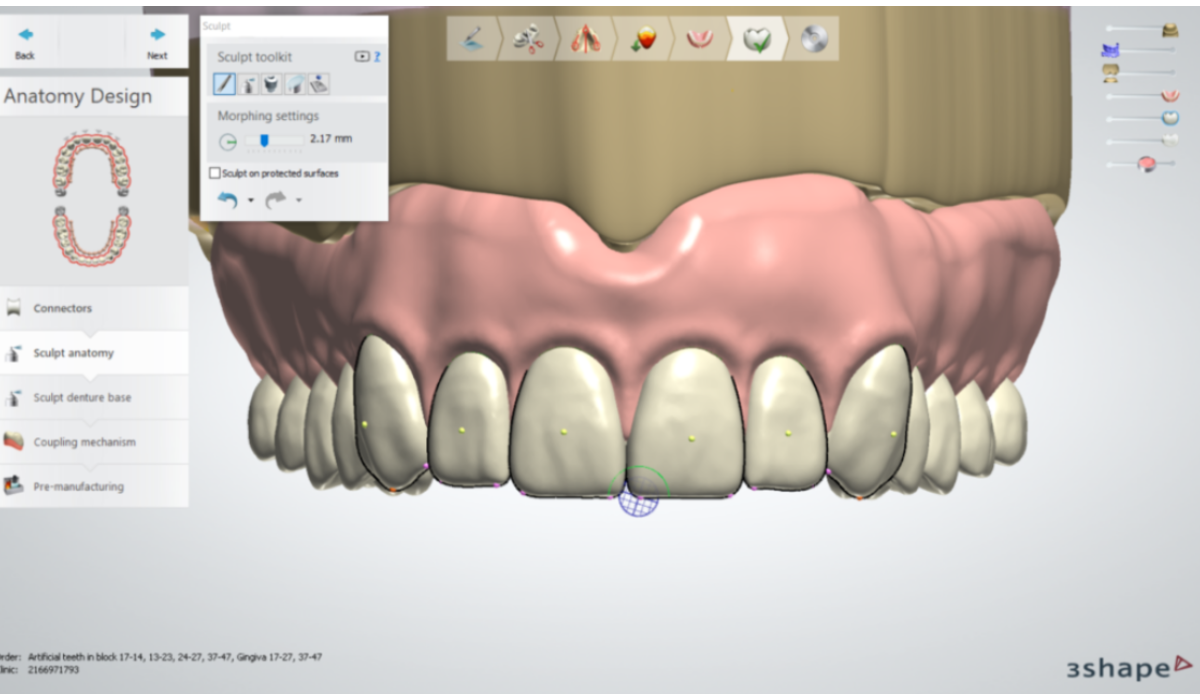 Unmatched Quality 3Shape Software Screenshot